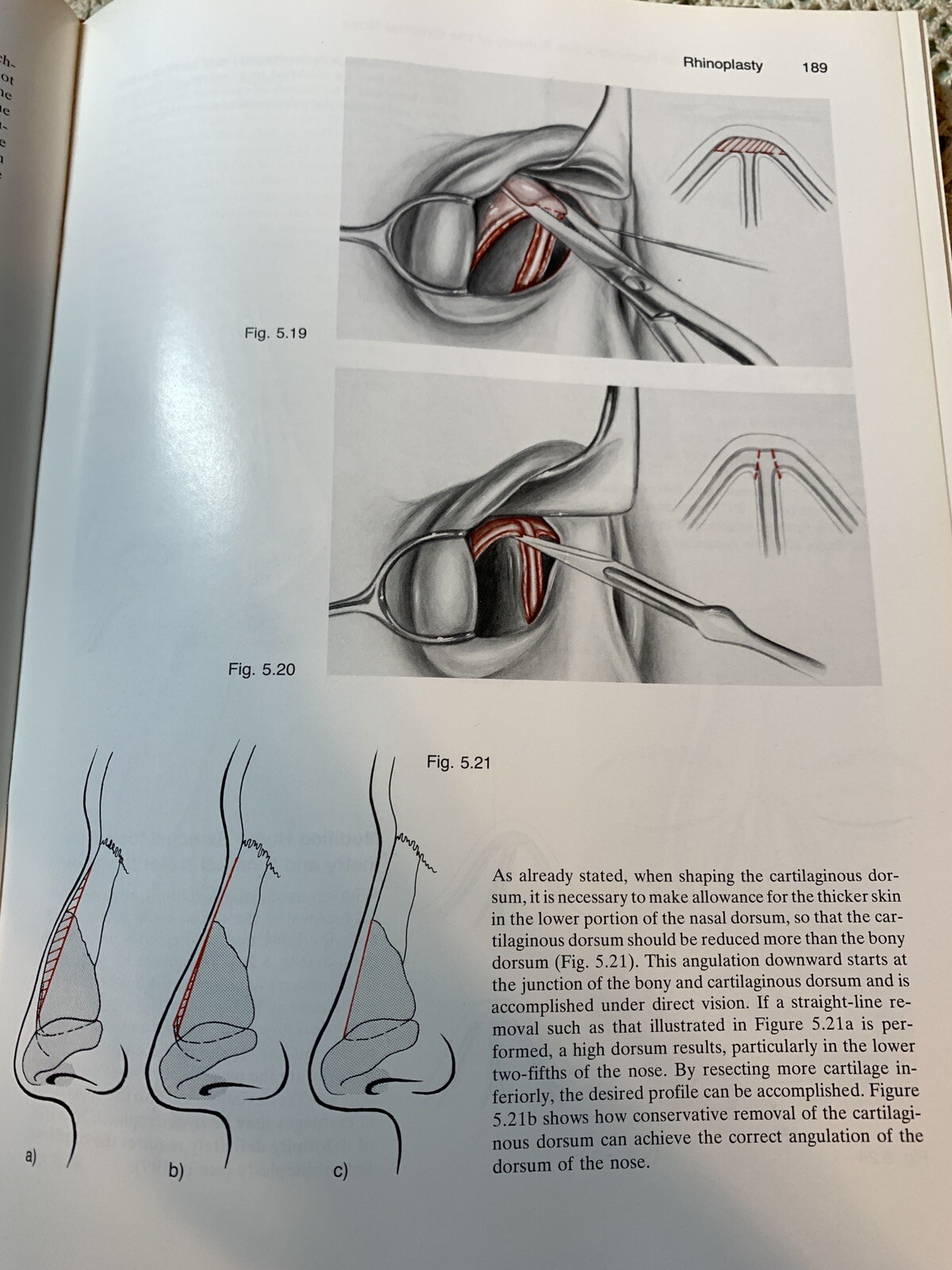Picture 15 of 20