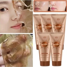 1-5X Herbal Spots Peel-Off Facial Mask, Skin Whitening&Moisturzing Improve Rough