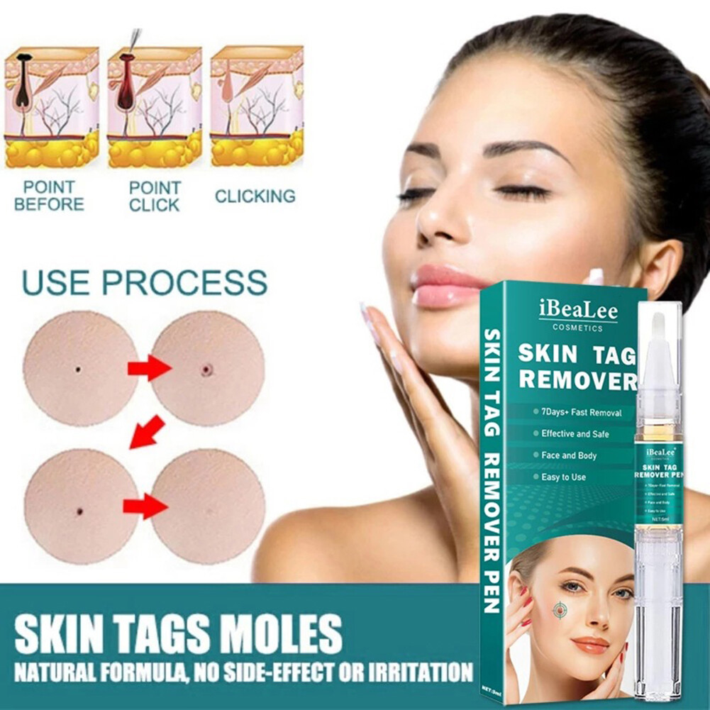 5ml Mole Remover Pens Natural Ingredients Flat Wart Treatment Skin Care