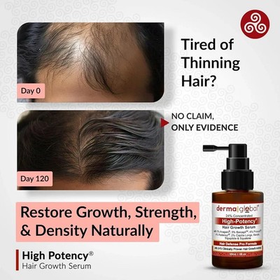 Derma Global Hair Defence Pro - Scalp Revitalizing Serum for Thinning Hair