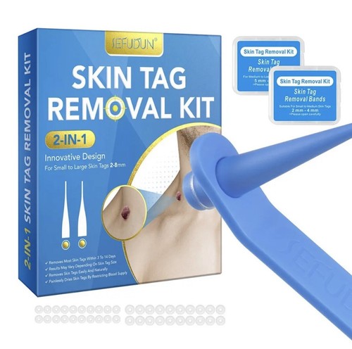 2 in 1 Natural Painless Auto SKIN TAG Removal kit Skin tag bands Remover Device - Picture 5 of 12