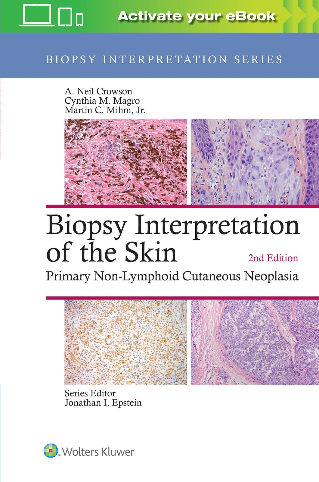 Thumbnail - A. Neil Crowson (u. A.) | Biopsy Interpretation Of The Skin | Buch |