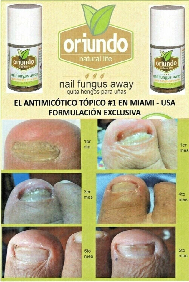 ORIUNDO Natural Life / Nail Fungus Away (Quita Hongos para Uñas) 0.5 OZ Nuevo EE. UU. Foto 4 de 4