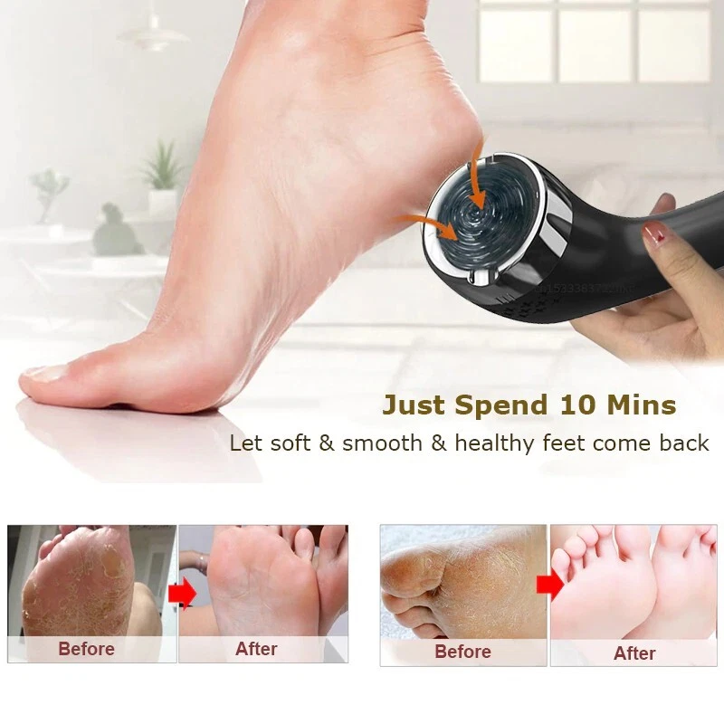 Electric Callus Remover For Feet Foot Sandpaper Pedicure Dead Skin Remover NEW