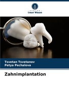 Tsvetan Tsvetanov (U. A.) | Zahnimplantation | Taschenbuch | Deutsch (2024)