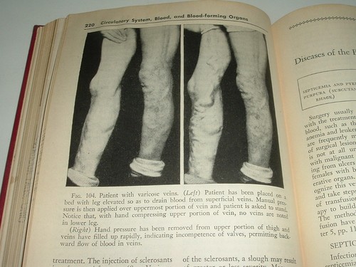 LQQK vintage 1946 hb. SURGICAL NURSING w/279 illustrations - Picture 15 of 18