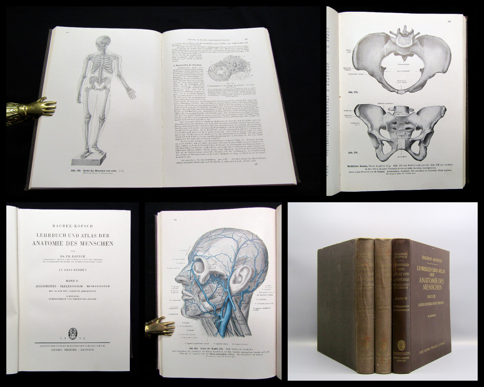 Kopsch Lehrbuch und Atlas der Anatomie des Menschen 1952 Bd. 1-3 komplett Wissen