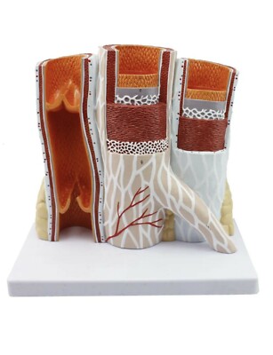Enlarged Human Blood Vessels Anatomical Model Arteriovenous Anatomy