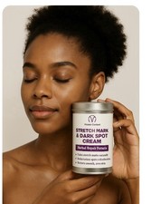 Stretch Mark Remover Repair Cream For Postpartum Pregnancy Scar  Skin Care