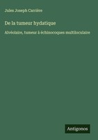 Jules Joseph CarrièRe | De La Tumeur Hydatique | Buch | FranzöSisch (2025)