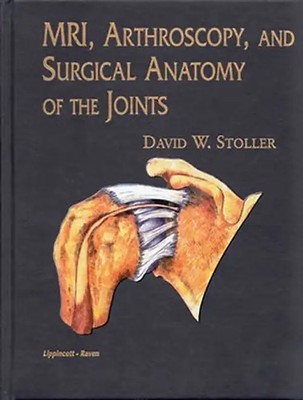 MRI, Arthroscopy, and Surgical Anatomy of the Joints - David W. Stoller
