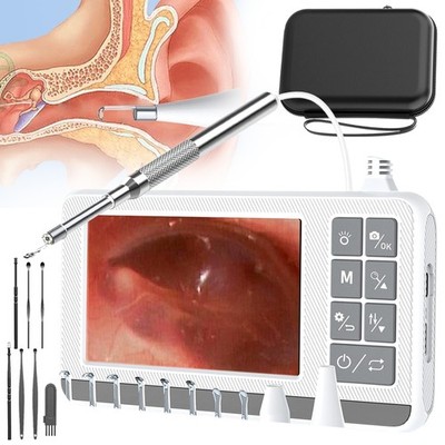 Ohrenschmalz Entferner Otoskop Ohrenreiniger Kamera Ear Cleaner mit 3.9mm Kamera
