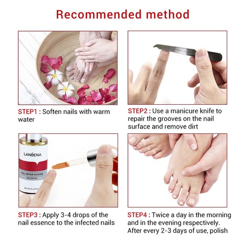 Nail Repair Serum Fungal Nail Treatment Liquid Remove Onychomycosis Toe Essence - Picture 13 of 16