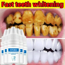 5/3Pcs Teeth Cleaning Gel Whitening Essence Serum Oral Hygiene dental Care Serum