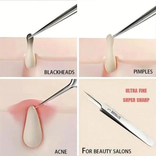 1 Pack No.5 Fine Acne Tweezers Blackhead Remover Needle Tool for Skin Care - Picture 13 of 24