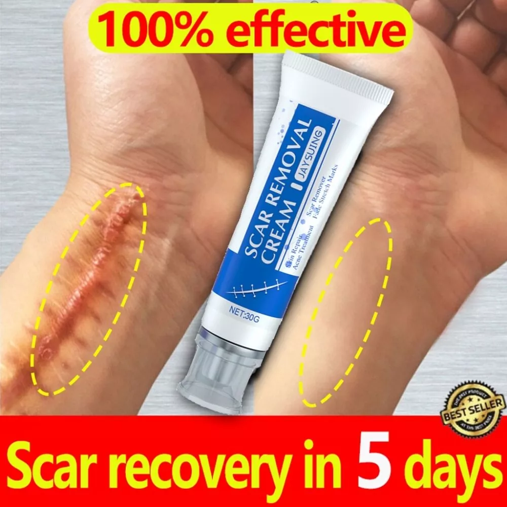 5 Day Recovery Scar Cream Fast Removal Skin Scars Treat Surgery