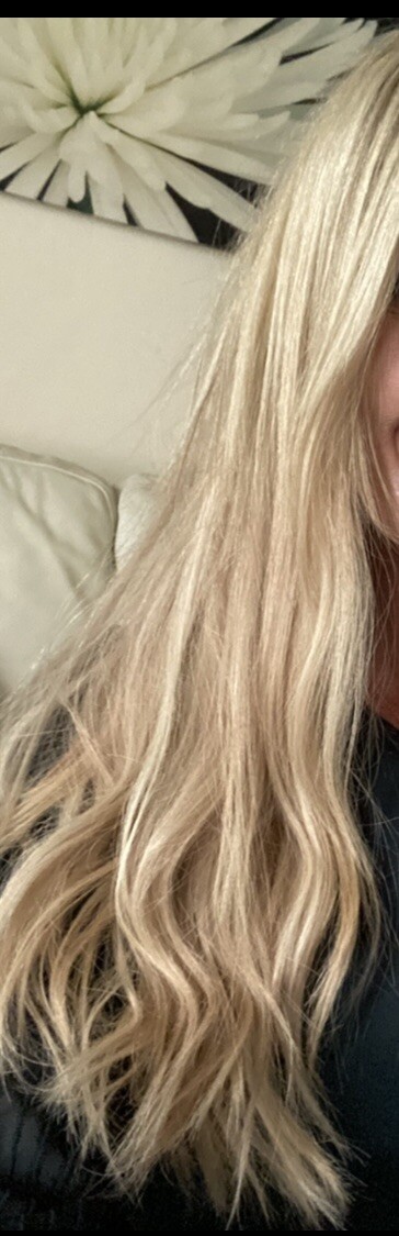Bild 2 von 5
