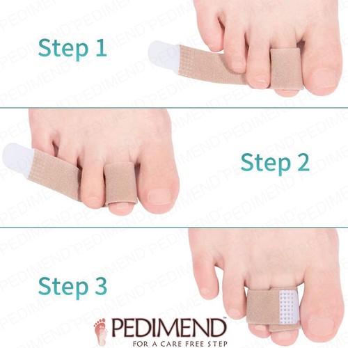Pedimend™ Hammer Toe Wraps for Overlapping Toes, Broken Toes & Crooked Toes - UK - Picture 6 of 10