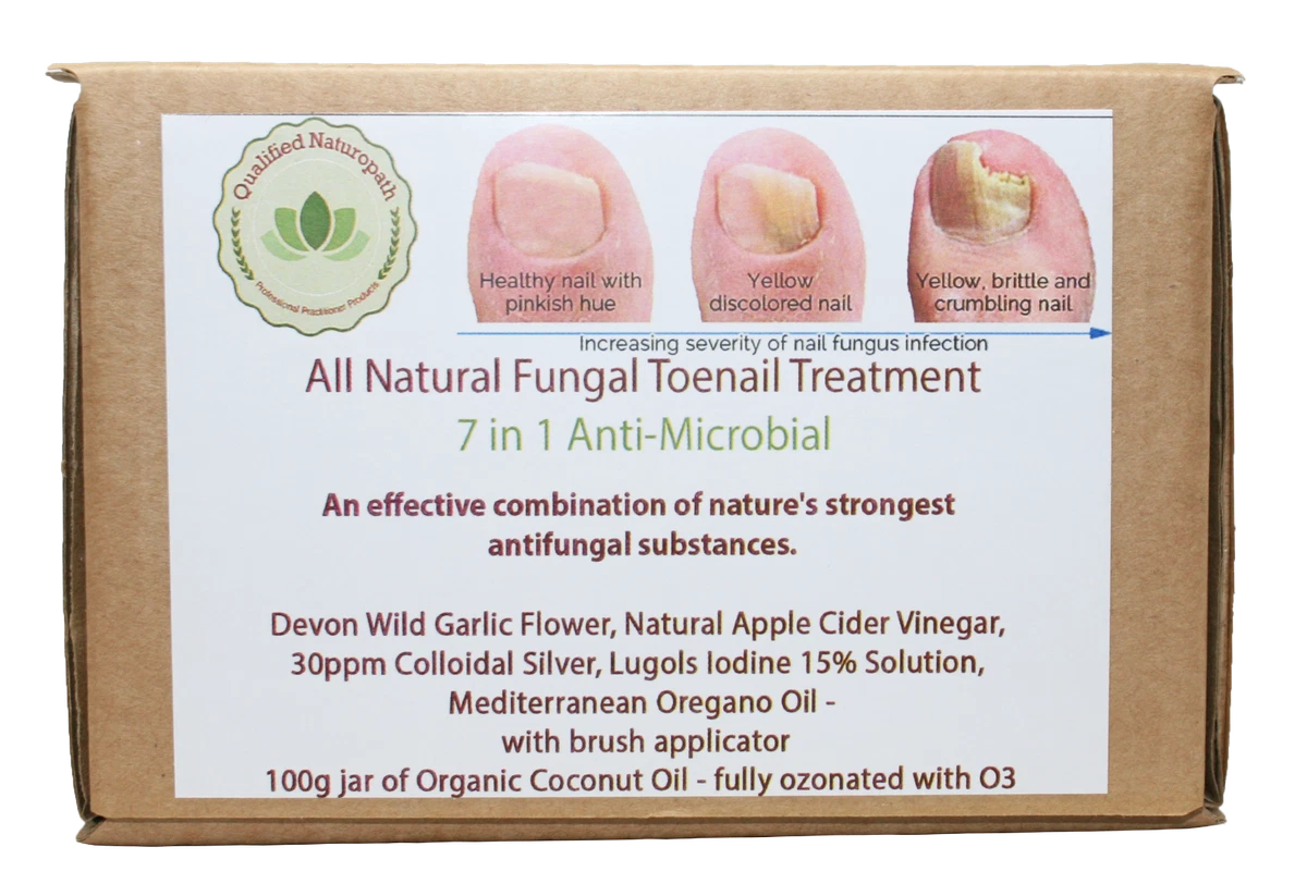 Top more than 103 toe nail fungus coconut oil super hot noithatsi.vn