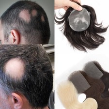 PU Skin Hairline Bald Spot Hair Patch Cover-up Frontal Remy Human Hair Hairpiece