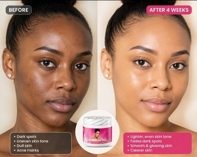 Queen White Face & Body Brightening Cream   Even Skin Tone & Glow Boost