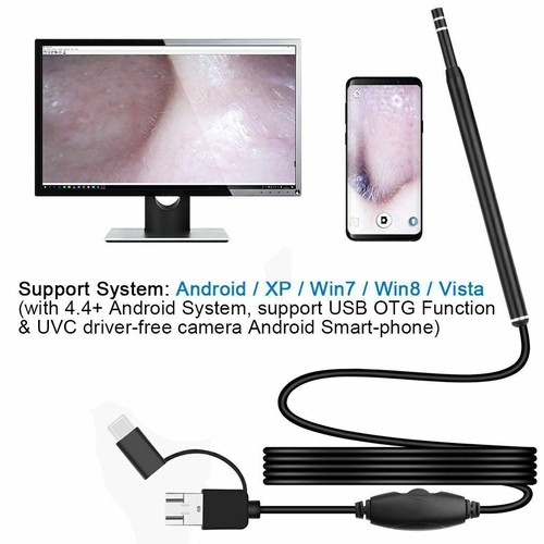 3 in 1 HD Ohr Reinigung USB Endoskop Ohrstocher mit Kamera HD Ohrenschmalz Entfernung Kit - Bild 10 von 12