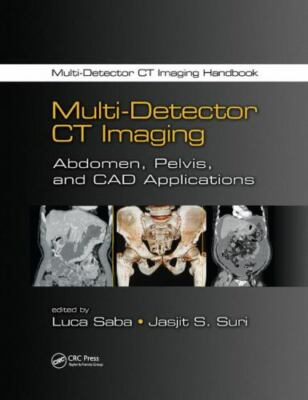 Multi-detector Ct Imaging : Abdomen, Pelvis, and CAD Applications, Paperback ...