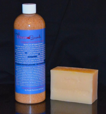 Acne ? you want CLEAR SKIN?  Perfect for all types of Acne