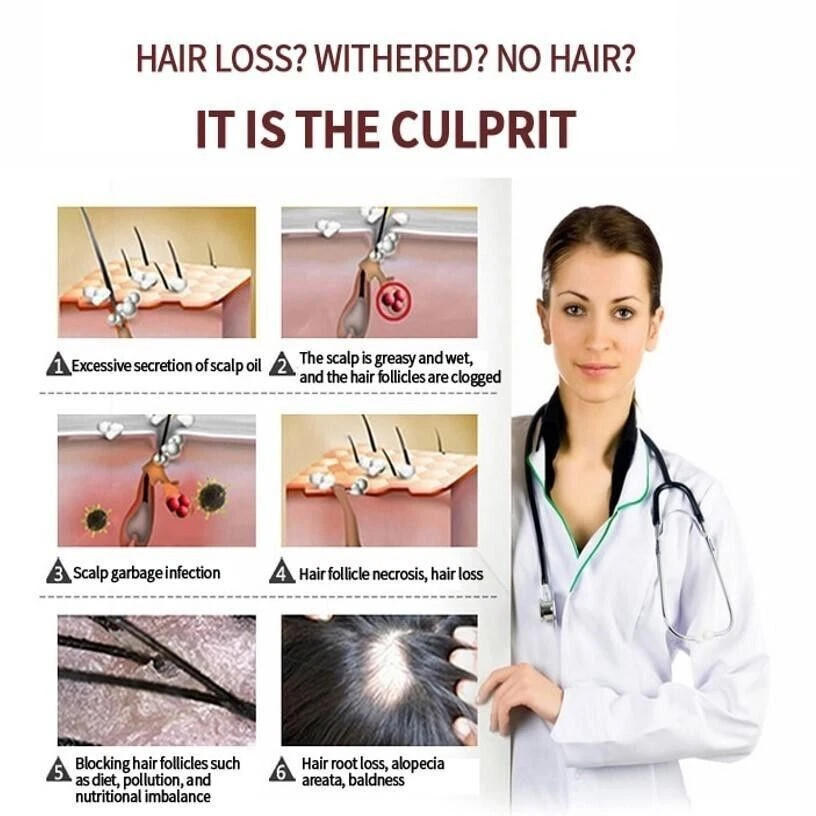 Champú herbal de jengibre - Crecimiento del cabello - Anticaída del cabello - Anti-picazón - Anticaspa Foto 3 de 4