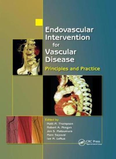 Endovascular Intervention for Vascular Disease:, Thompson, Morgan, Matsu PB..