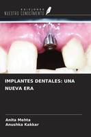 Implantes Dentales: UNA Nueva ERA Anita Mehta (U. A.) Taschenbuch Spanisch 2022
