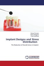 Raziya Perween (u. a.) | Implant Designs and ...