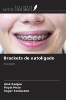 Alok Ranjan (U. A.) | Brackets De Autoligado | Taschenbuch | Spanisch (2022)