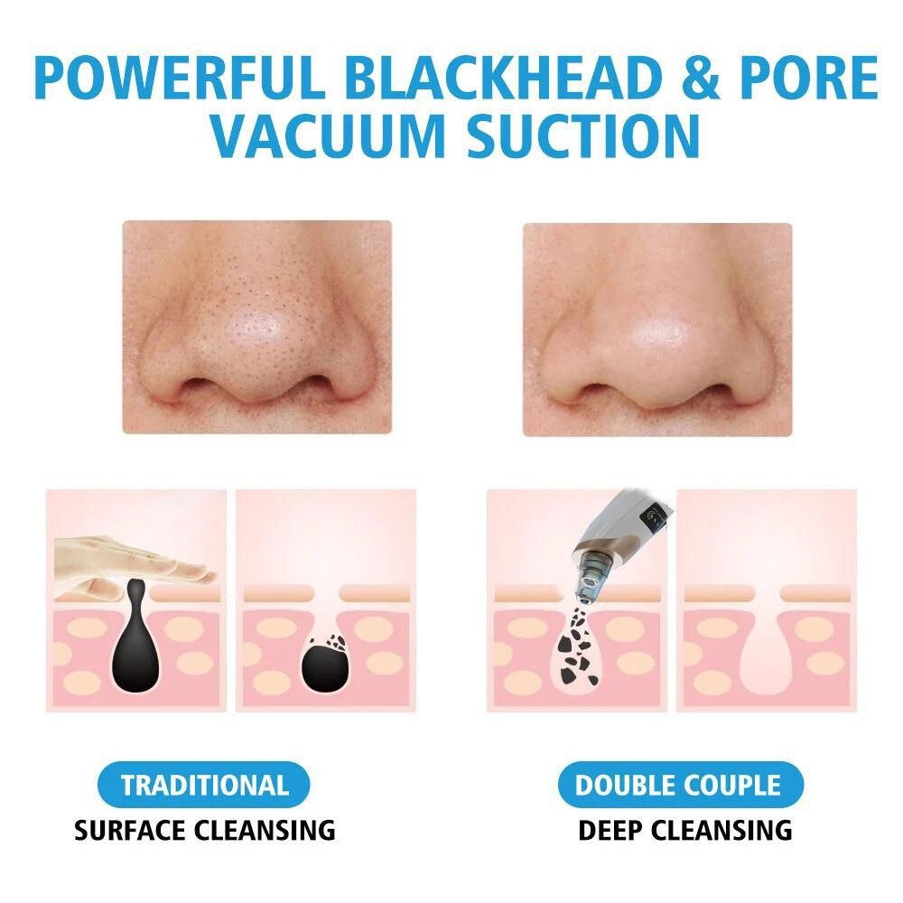 Electric blackhead suction device, pore facial cleansing massage device POP