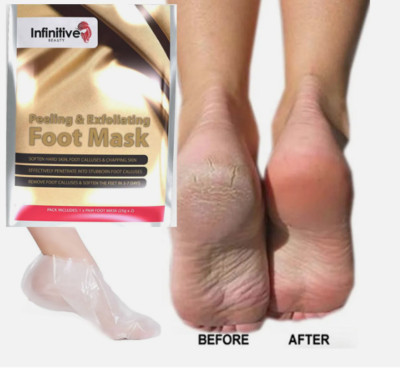 Peel Off Peeling Fußmaske entfernt harte abgestorbene Haut Hornhaut Socken weiche Füße