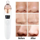 Electric Blackhead Facial Remover Vacuum Pore Cleaner Skin Face Machine Acne Dot