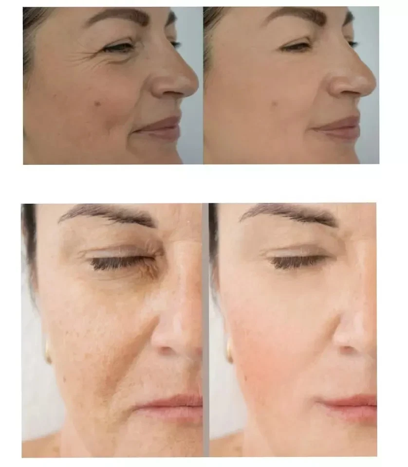 Eslow Anti-age Siero Viso Antietà Levigante Rughe con Esosomi e Acido Ialuronico - Immagine 2 di 2