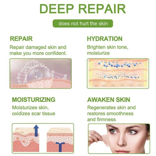 Scar Silicone Sheet Gel Patch Removal Skin Treatment Repair Wound Burn TOP NEW - Picture 10 of 14