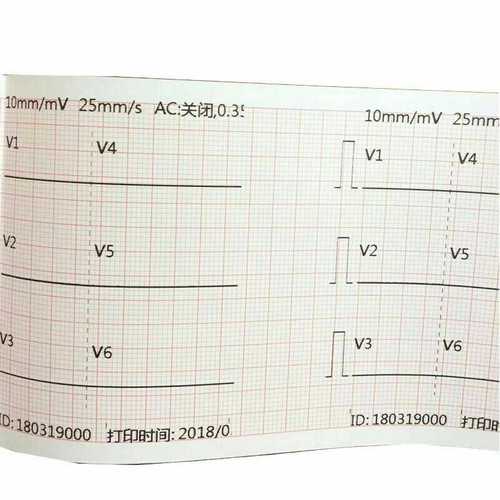 5pcsThermal Printer Paper 80mm*20m Printing Paper for CONTEC ECG Machine ECG300G - Picture 11 of 12