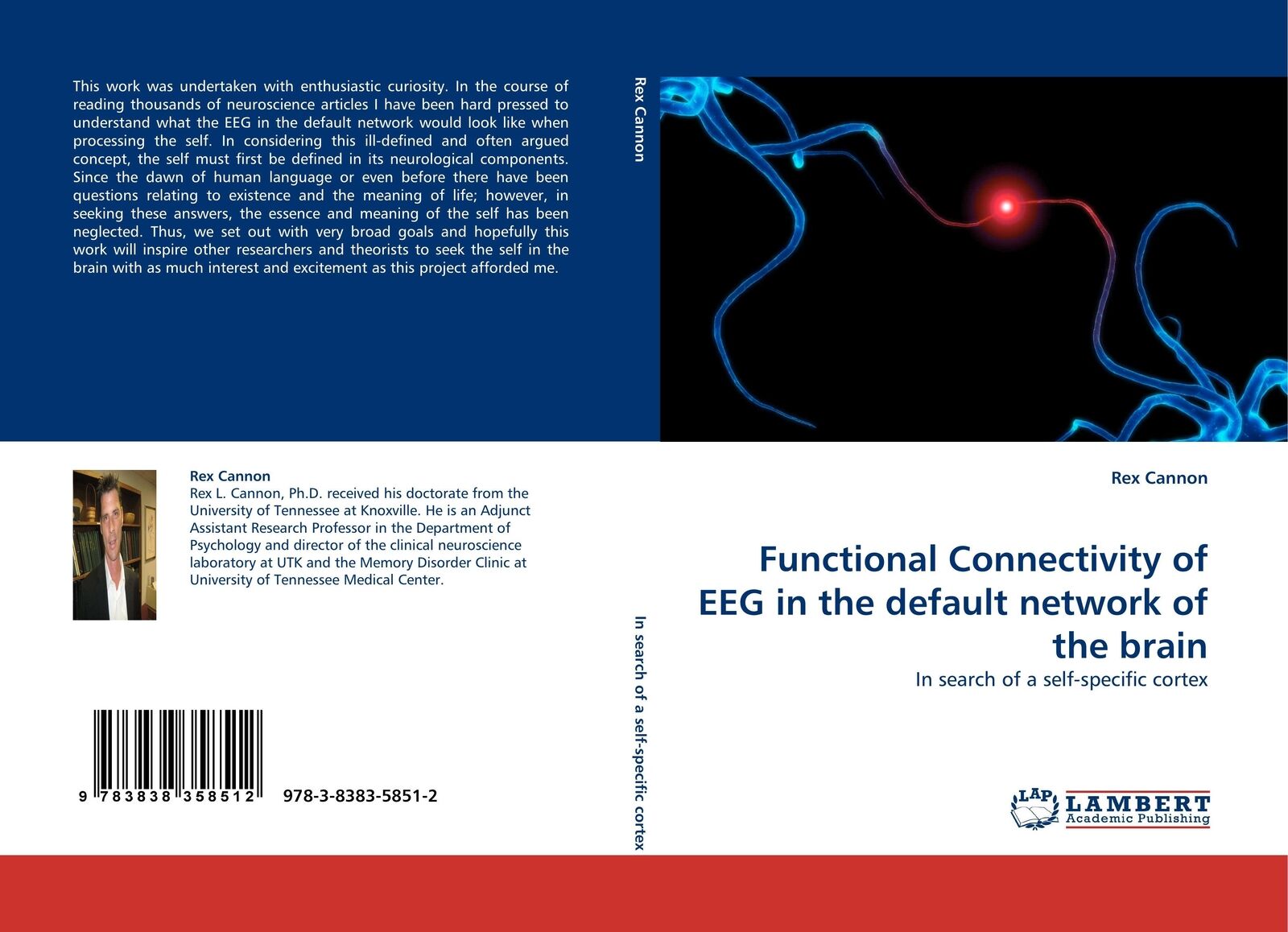 Thumbnail - Rex Cannon | Functional Connectivity Of Eeg In The Default Network Of