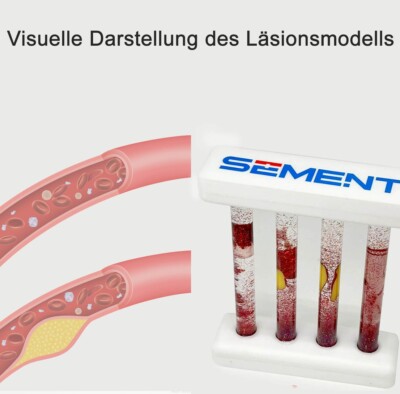1PCS Modell des Gefäßpathologies mit Blutflusssimulation, medizinisches Train DE