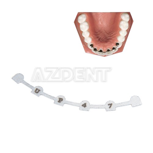 Dental Orthodontic Lingual Retainer Tooth Bonding Splits Wire Mesh Backing Mark - Picture 4 of 6