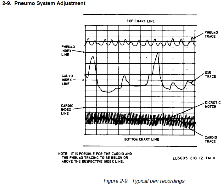 Polygraph Chart Tracings