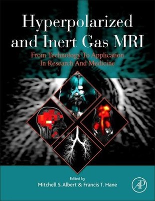 Mitchell S. Albert Hyperpolarized and Inert Gas MRI (Gebundene Ausgabe)