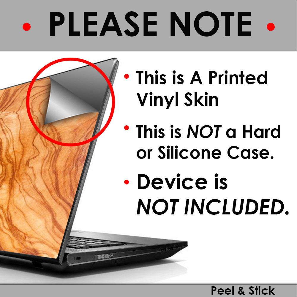 Autocollants Skins Pour Acer Chromebook R13 - Vinyle Bleu Fluo Jaune Trippy - Neuf Sous Emballage - Marque Itsaskin1
