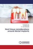 Priyanka Jeve (U. A.) | Hard Tissue Considerations Around Dental Implants | Buch