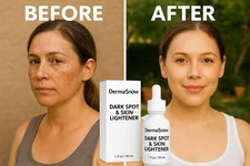 Age Spot Remover – Dark Spot Corrector for Face & Body - Anti Aging Serum