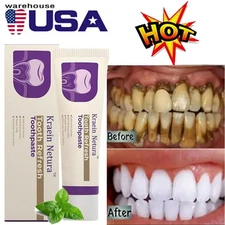100ml KREAIN Nature Oral Care Toothpaste for Toothacne & Sensitivity &Bad Mouth