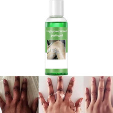 Extra Strong Peeling Oil, Peeling Oil for Dark Skin, Green Peeling Oil, Exfoliat