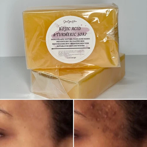 KOJIC ACID &TURMERIC SOAP